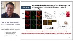 Разные формы глаукомы – одинаковы ли подходы к гипотензивному лечению