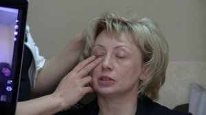 Коррекция нижнего века