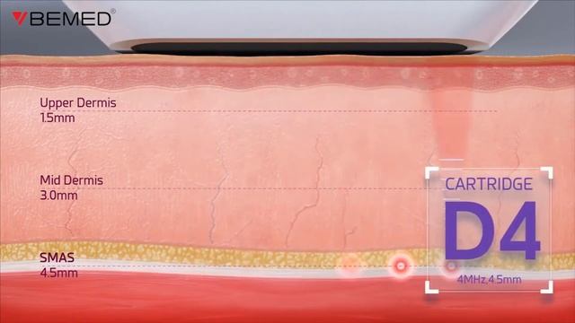 DOUBLO GOLD - TRẺ HÓA XÓA NHĂN CHỈ SAU 8 PHÚT смотреть онлайн