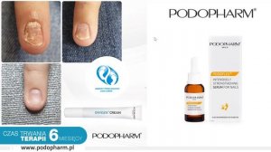 Онихолизис. Лечение средствами Podopharm