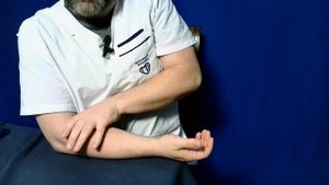 Как улучшить движения в локтевом суставе после травмы