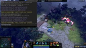 ЭТИ НАСТРОЙКИ ДОТЫ РУИНЯТ ИГРЫ | Худшие настройки в доте, которые надо отключить Dota 2