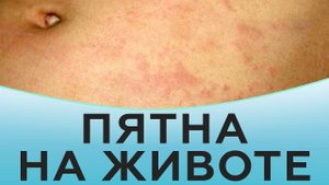 Пятна на животе