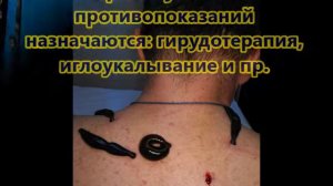 Лечебное голодание в Горячинске