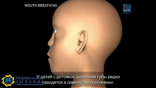 Причины возникновения неправильного прикуса смотреть онлайн