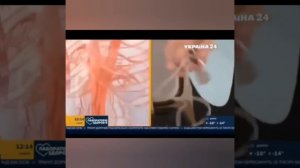 Новый вид массажа активно используют в мед учреждениях.