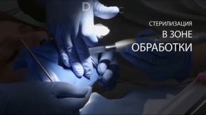 Лечение клиновидного дефекта с помощью лазера в DLclinic