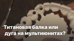 Титановая балка или дуга на мультиюнитах? Как избежать поломок. Зубной техник обучение моделирование