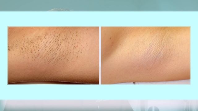 Lazer M22 смотреть онлайн