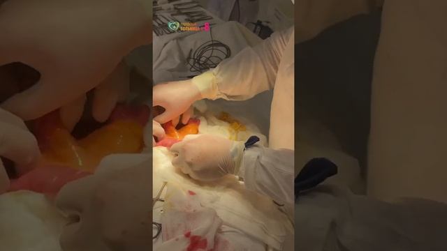 Врачи вытащили цепня из кишечника мужчины