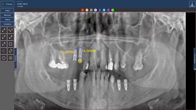 ArchiMED Suite - Image Calibration - смотреть онлайн