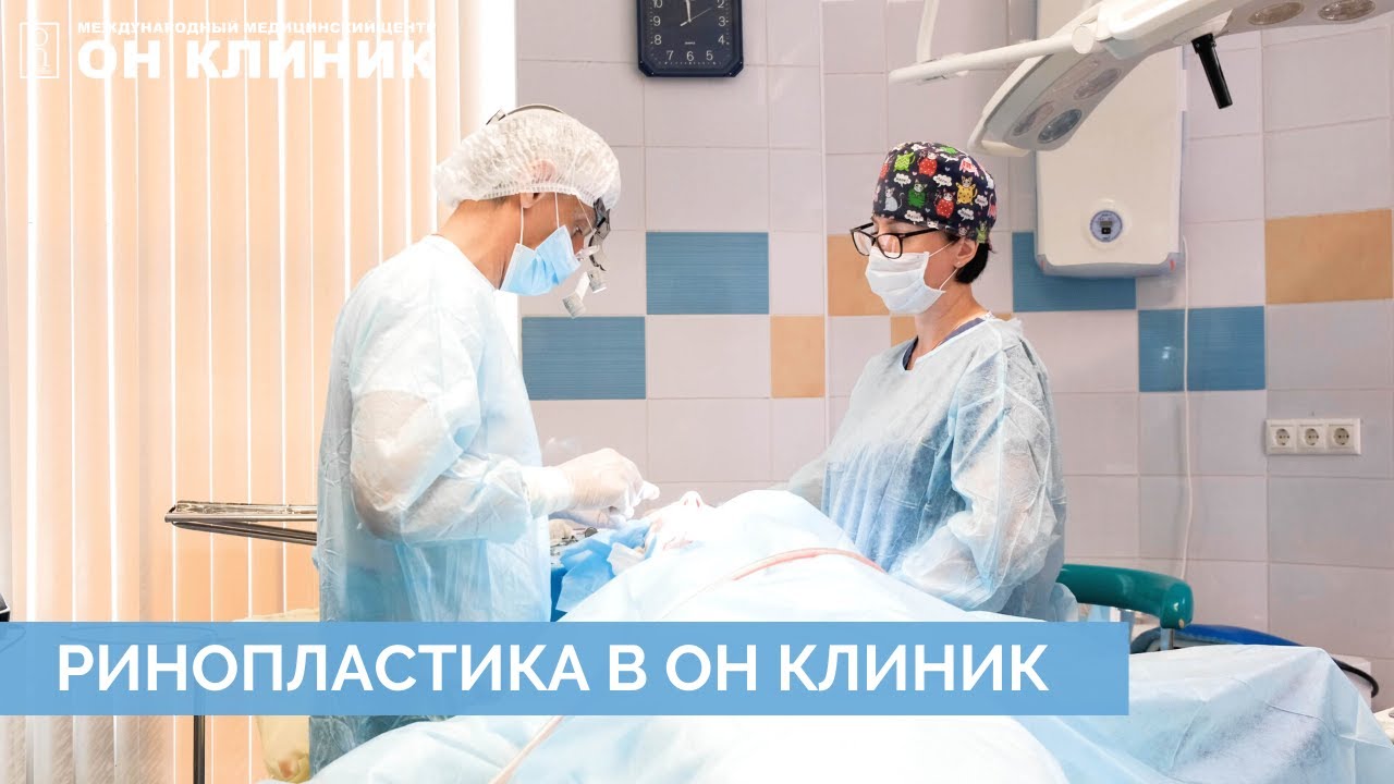 Ринопластика в ОН КЛИНИК. Результат сразу после операции. Отзыв пациентки через 2 недели.