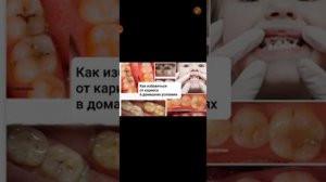 Как избавиться от кариеса в домашних условиях