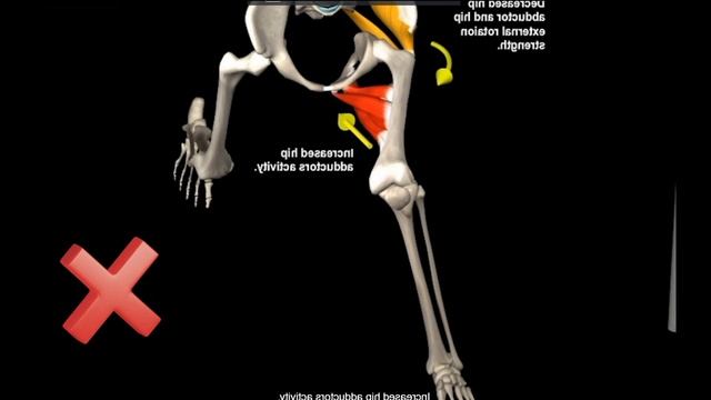 Боль в колене при подъёме по ступенькам, беге, ходьбе. Пателлофеморальный синдром. Колено бегуна смотреть онлайн