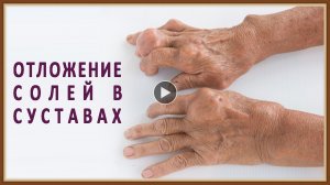 ОТЛОЖЕНИЕ СОЛЕЙ В СУСТАВАХ.mp4