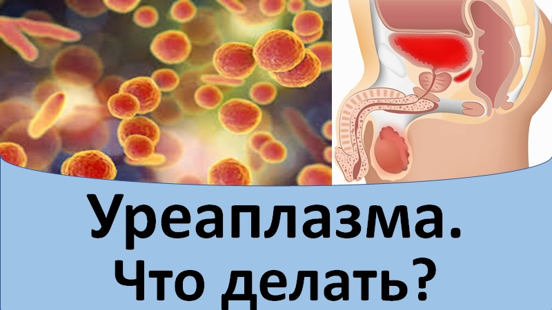 Уреаплазма. Что делать?