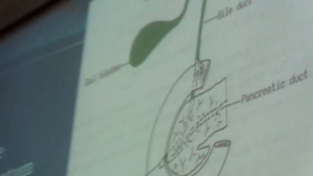 GIT revision Dr Sayed Metwally part 3 смотреть онлайн