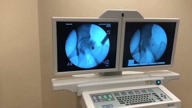 внутрисуставные инъекции НЕ помогает и что делать