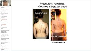 Санжай Жапов   целитель, остеопат,лечение сколиоза, плоскостопия и др