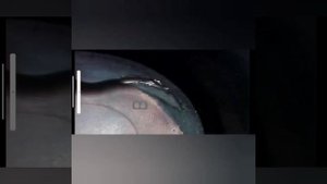 lexus gx470 2UZ VVT-I гнёт ли клапаны, при обрыве ремня?