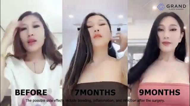 Клиника пластической хиругии Гранд раскроет все грани вашей красоты! смотреть онлайн