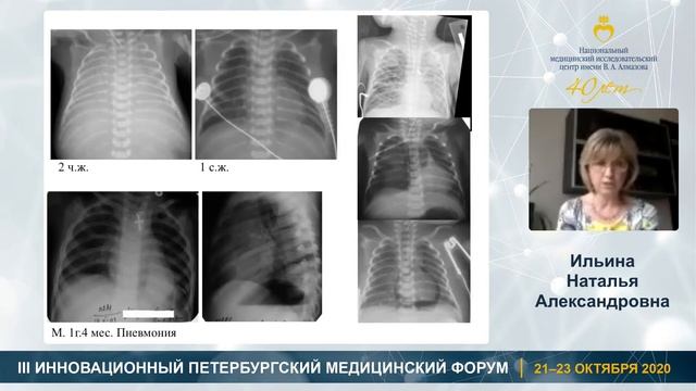 58 Лучевая диагностика в перинатологии и педиатрии. Заседание 2