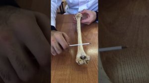 Нормальная анатомия плечевой кости.