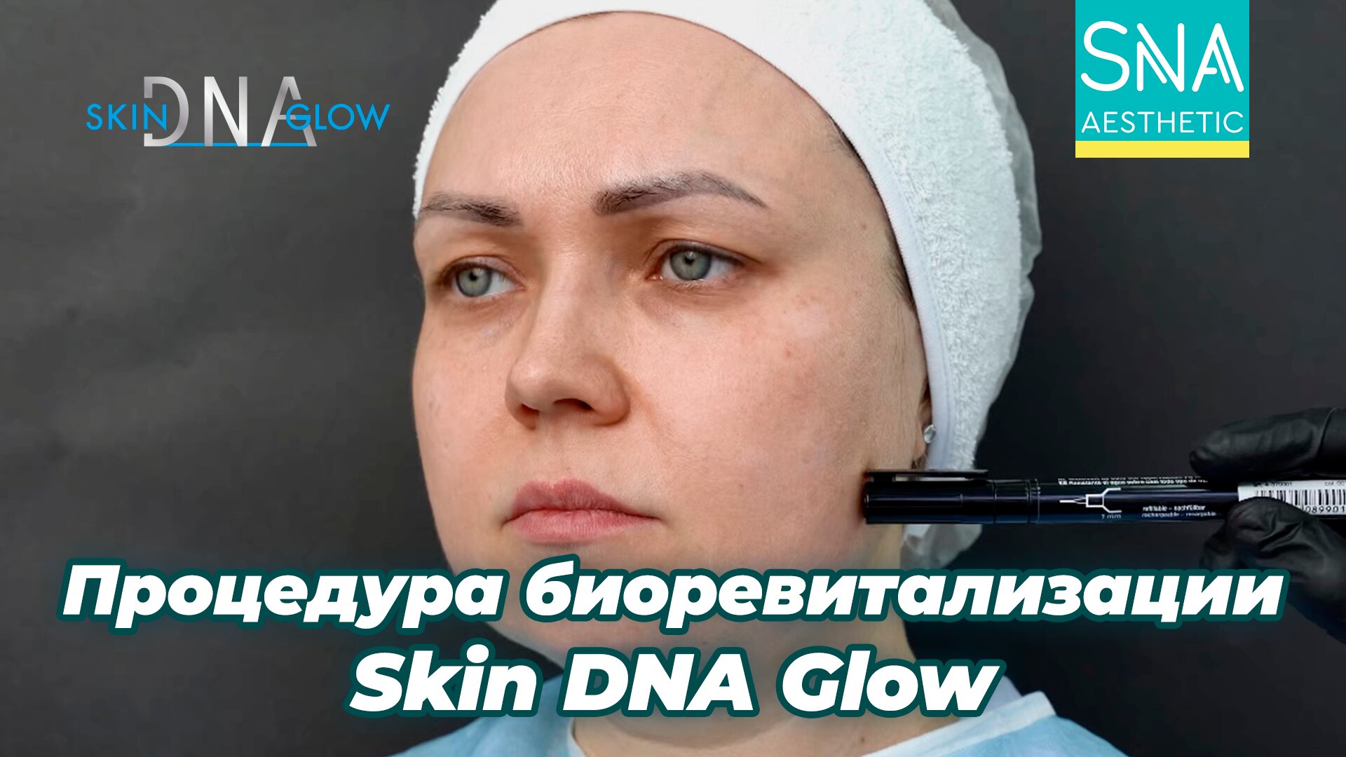 Процедура биоревитализации Skin DNA Glow пошагово.