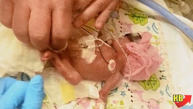 Эта девочка родилась весом всего 280 грамм. Посмотрите как она выглядит сегодня. смотреть онлайн