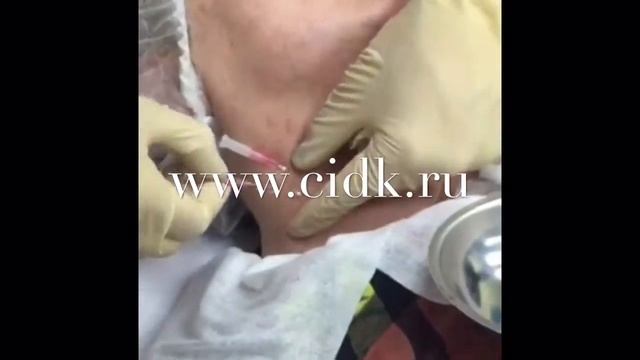 МЕЗОНИТИ Reandne V-line в ЦИДК смотреть онлайн