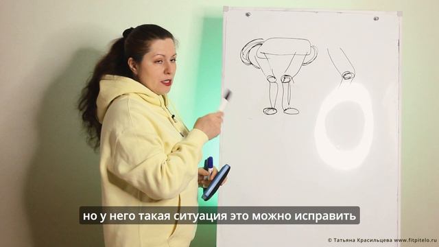 Ноги иском, что делать? Вальгус и псевдовальгус.