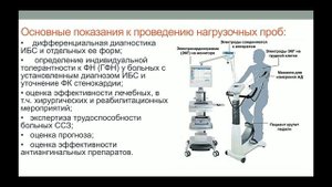 Атеросклероз. ИБС. Стенокардия напряжения (стабильная стенокардия). Часть 2.