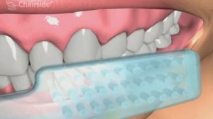 Техника чистки зубов выметающими движениями