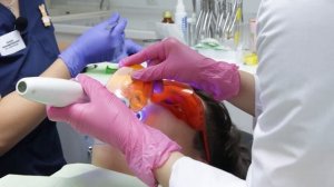 Фиксация брекет-системы Damon Q2. Сеть клиник эстетической стоматологии "Мастер Улыбок"