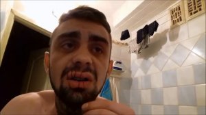 ШОК! ЗАШИЛ СЕБЕ РОТ:D