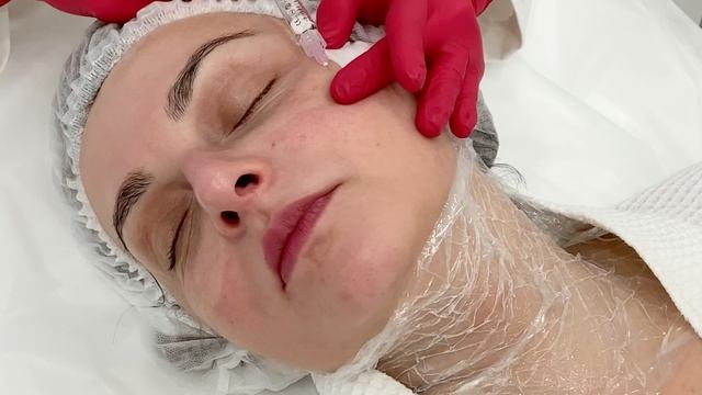 Дневник поколения Ageless. Героиня Елена (3 СЕРИЯ) | Сеть клиник косметологии GEN87