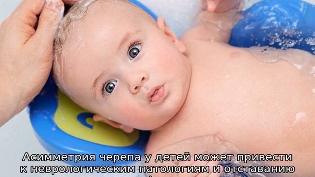 Череп новорожденного: анатомия, причины деформации, условия выравнивания