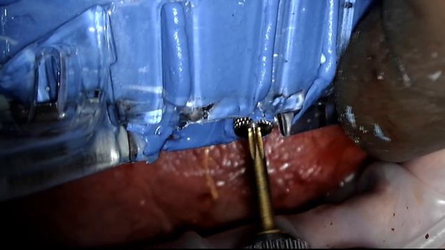 Снятие оттисков смотреть онлайн