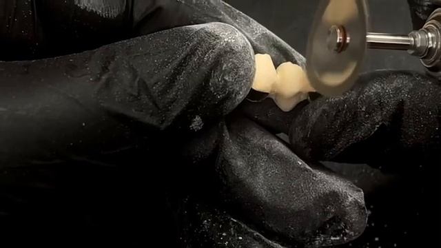 Нанесение керамики. 3 единицы. Мостик смотреть онлайн