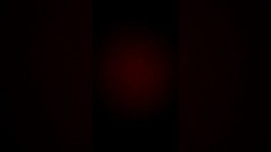 Болит животик 😖 Набираем 2❤️ снимаю как какаю ❤️😖