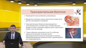 19:30 06.03.2022 Биопсия предстательной железы