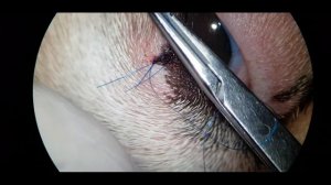 Клиновидная резекция новообразования верхнего века у собаки, дебридмент роговицы