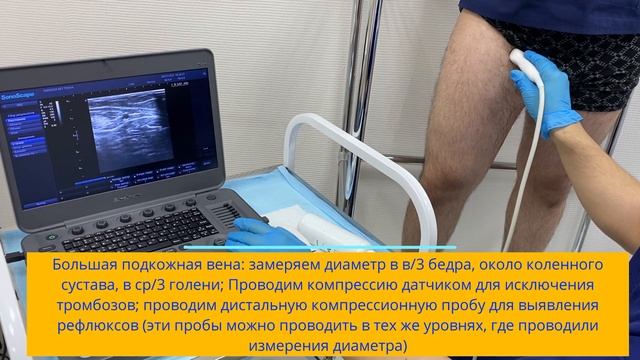 #УЗИ  #вен нижних конечностей.  #дуплексное #триплексное сканирование вен.