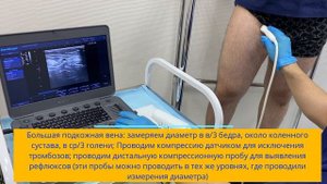 #УЗИ  #вен нижних конечностей.  #дуплексное #триплексное сканирование вен.