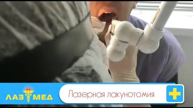 Лазерная лакунотомия смотреть онлайн