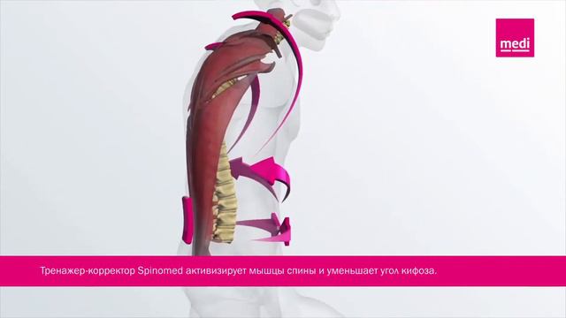 Тренажер-корректор Spinomed® для лечения остеопороза смотреть онлайн