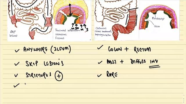 INFLAMMATORY BOWEL DISEASE II GIT II ROBBINS 10TH E II PATHOLOGY LECTURES II @DrJIBRANAHMED смотреть онлайн