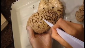 Анатомия человека  Мозг