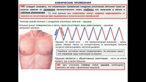 Синдром уплотнения легочной ткани