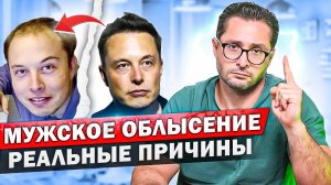 Мужское облысение. Что делать при выпадении волос? Причины и виды лечения.